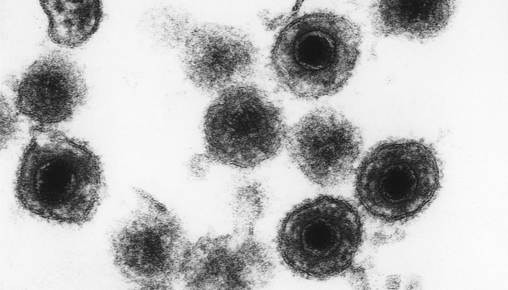 <p>Le HHV-6A et le HHV-6B peuvent intégrer leur génome aux chromosomes humains. De plus en plus d'études lient la présence du HHV-6A au développement de l'alzheimer. Pour sa part, le HHV-6B cause la roséole, une maladie infantile très courante. </p>