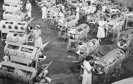 Cette photo, prise en 1952 en Californie, rappelle que des étages complets d'hôpitaux étaient occupés par des enfants frappés par la polio. Lorsque les muscles respiratoires étaient atteints, les malades devaient être placés dans un poumon d'acier.