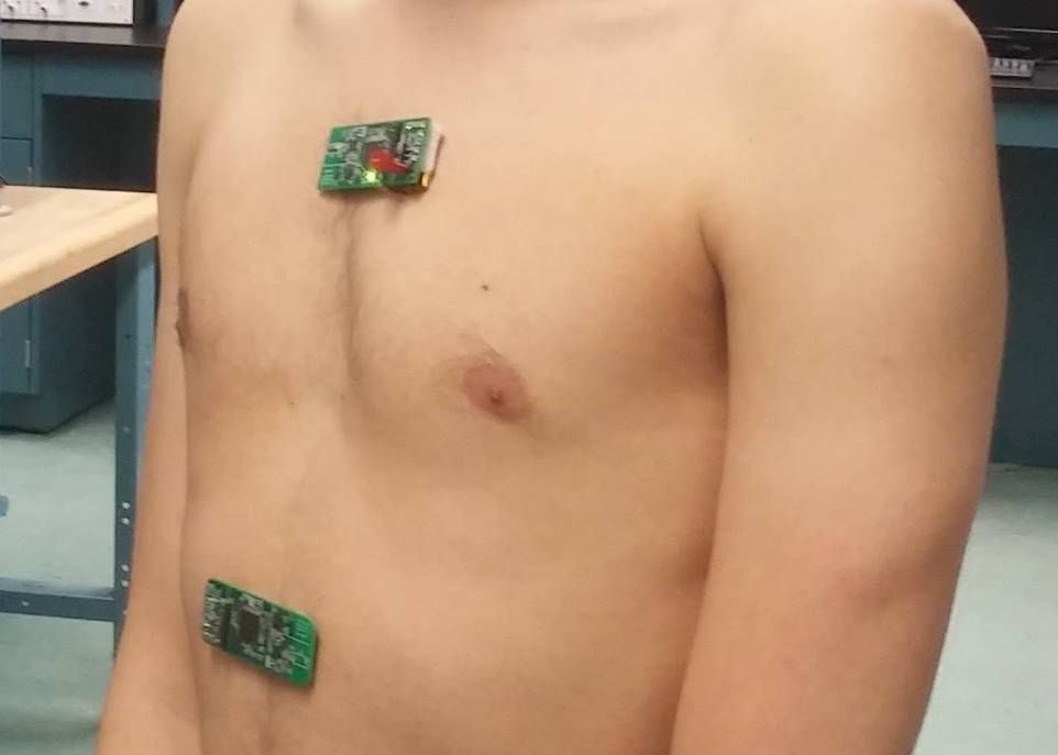 Les deux timbres épidermiques intelligents contiennent un accéléromètre et un gyroscope servant à déterminer le rythme respiratoire. Le timbre installé sur le thorax contient aussi un système microélectromécanique servant à établir la fréquence des quintes de toux.