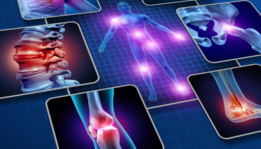 L'inflammation des articulations est l'un des nombreux symptômes du lupus.