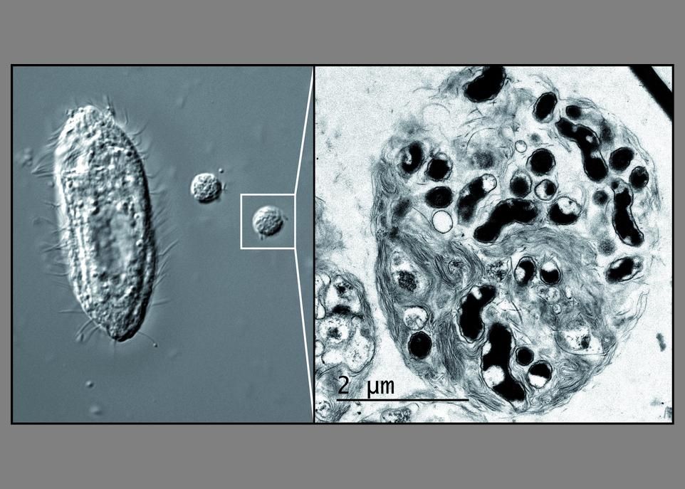 <p>Cette image montre, à gauche, T. pyriformis, un protozoaire qui se nourrit de bactéries, et deux structures qu'il a expulsées et qui contiennent des déchets de digestion. À droite, un grossissement de l'une de ces structures montre, en noir, des bactéries de l'espèce C. jejuni qui ont résisté au processus de dégradation. Les couches de lipides dont elles sont enrobées favoriseraient la survie et la propagation de ces bactéries, qui causent des intoxications alimentaires chez l'humain.</p>