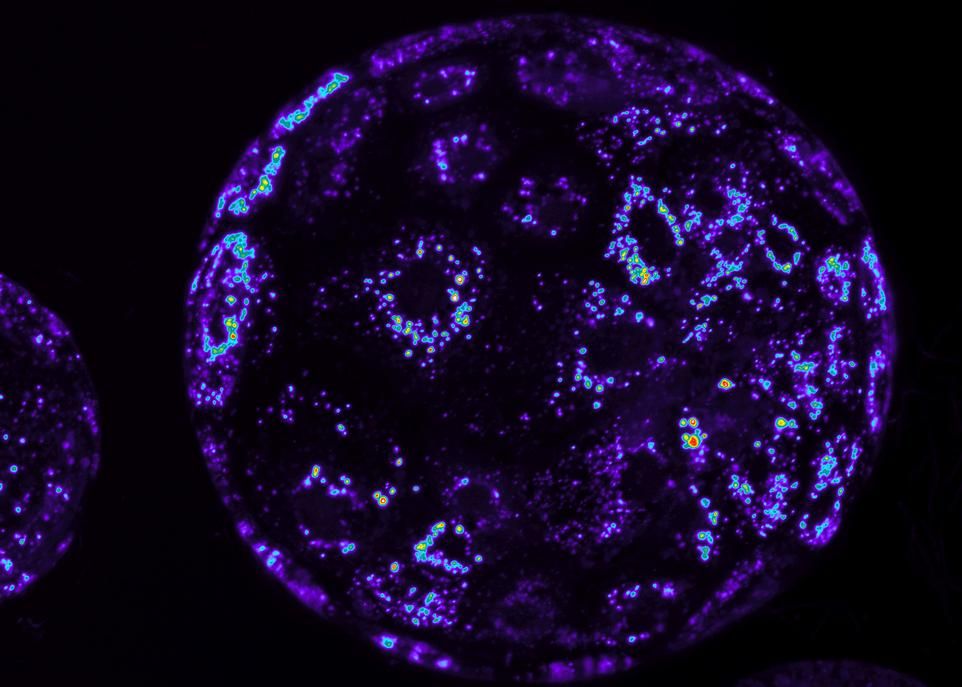 Sur cette photo montrant un embryon porcin âgé de sept jours, les couleurs chaudes représentent les zones où les mitochondries, les centrales d'énergie de la cellule, sont particulièrement actives. L'alcool entrave le fonctionnement normal des mitochondries pendant une période critique du développement embryonnaire et réduit de 43% le taux de survie des embryons.