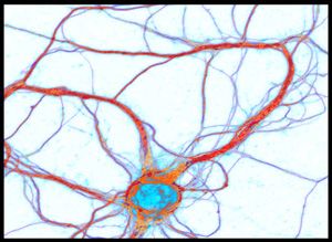 La molécule motrice KIF3C (en bleu) se lie à la tubuline (en rouge) des microtubules et transporte les ARN à partir du noyau jusqu'à l'extrémité des cellules nerveuses.
