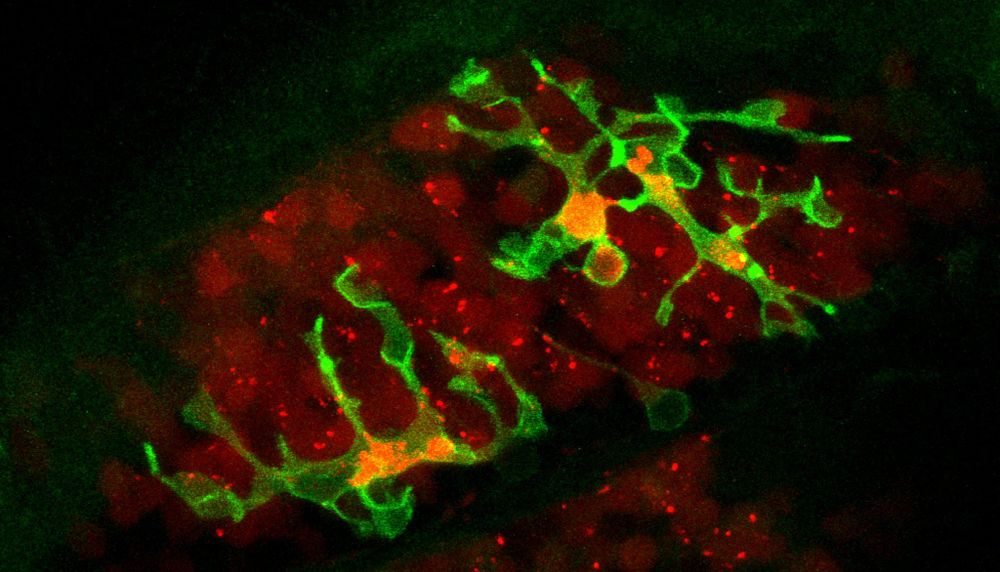 Grand ménage neuronal est l'œuvre d'Odessa Tanvé, doctorante en neuroscience à l'Université Laval. Cette image microscopique permet de voir le développement du cerveau d'une larve de poisson-zèbre âgée de neuf jours. 