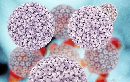 Le modèle développé par le professeur Brisson tient compte de nombreuses variables liées à la biologie du VPH ainsi qu'à la dynamique de la sexualité humaine. Il a fallu recourir au superordinateur Colosse de l'Université Laval pour effectuer les calculs.
