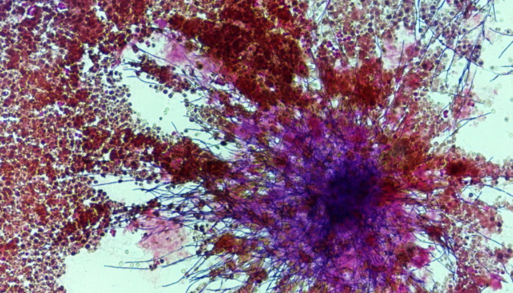 <p>Candida albicans un champignon qui vit dans les muqueuses du corps humain. Quand certaines conditions sont réunies, il devient virulent et engendre des infections qui peuvent conduire à des candidémies mortelles.</p>