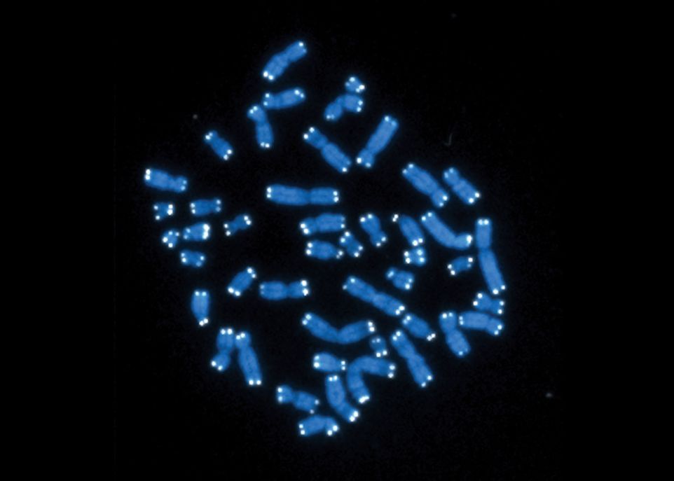 telomeres-credit-National-Institutes-of-Health