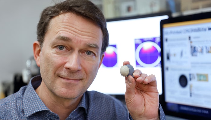 Le professeur Marc-André Fortin a mis à profit son expertise pour relever les défis que pose le traitement du cancer de l'œil.