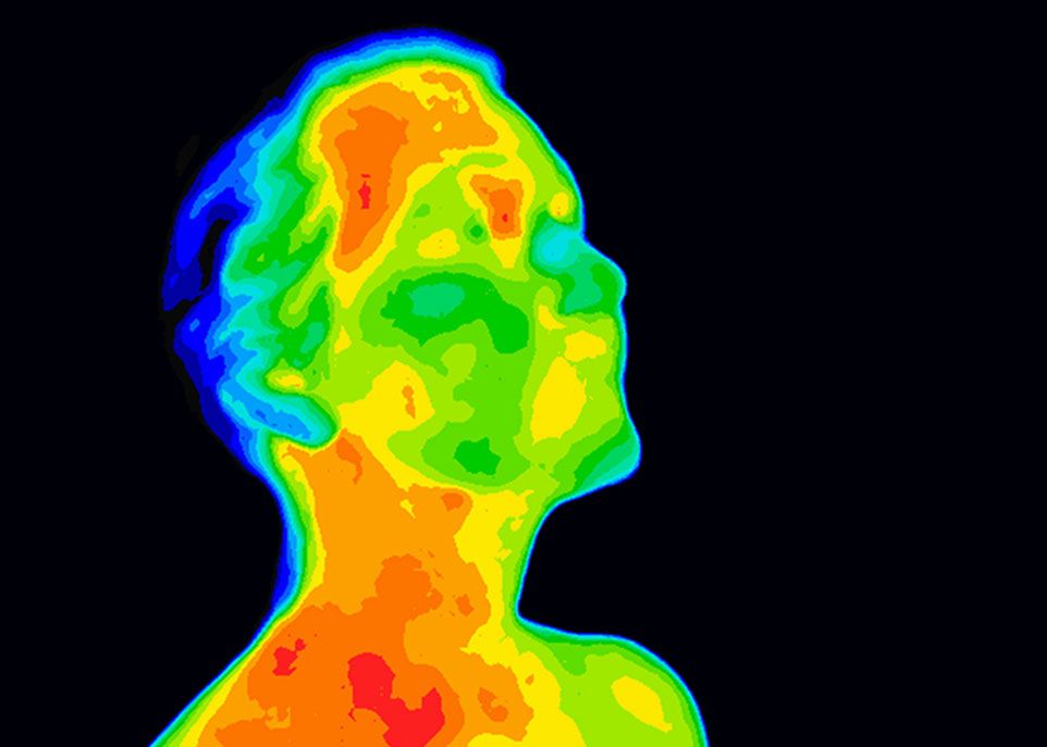 L’incidence de l’alzheimer est faible avant 65 ans, mais elle double tous les 6 ans par la suite. Cette hausse correspond à une période de la vie pendant laquelle le métabolisme et la température corporelle diminuent chez les personnes âgées. De plus, l’alzheimer touche des zones du cerveau impliquées dans la thermorégulation, ce qui pourrait créer un cercle vicieux.