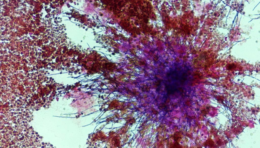 <p>Candida albicans est un champignon qui cause des infections généralement bénignes. Par contre, chez les personnes immunosupprimées, il peut causer des infections systémiques graves, voire des décès. Des souches résistantes aux antibiotiques ont fait leur apparition chez cette espèce.</p>