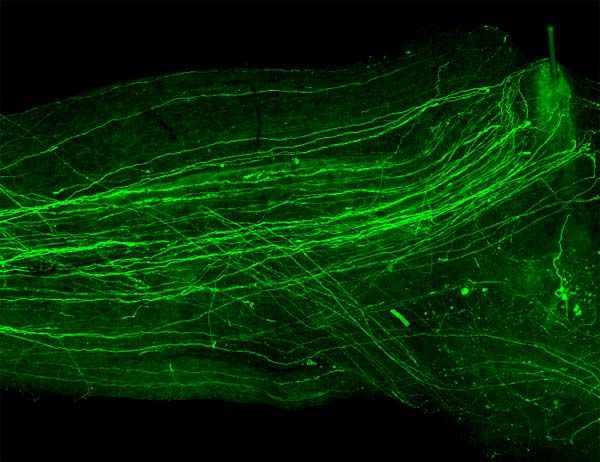 L'action de certaines cellules immunitaires favoriserait la régénération des axones après une lésion. Cette photo a été prise chez une souris transgénique qui synthétise une protéine fluorescente dans ses neurones.