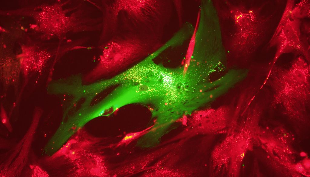 <p>Un fibroblaste, en vert, entouré de cellules endothéliales. Les fibroblastes produisent des protéines qui servent de matrice au tissu conjonctif de la peau. Cette matrice permet de reconstituer le derme au niveau d'une lésion cutanée.</p>