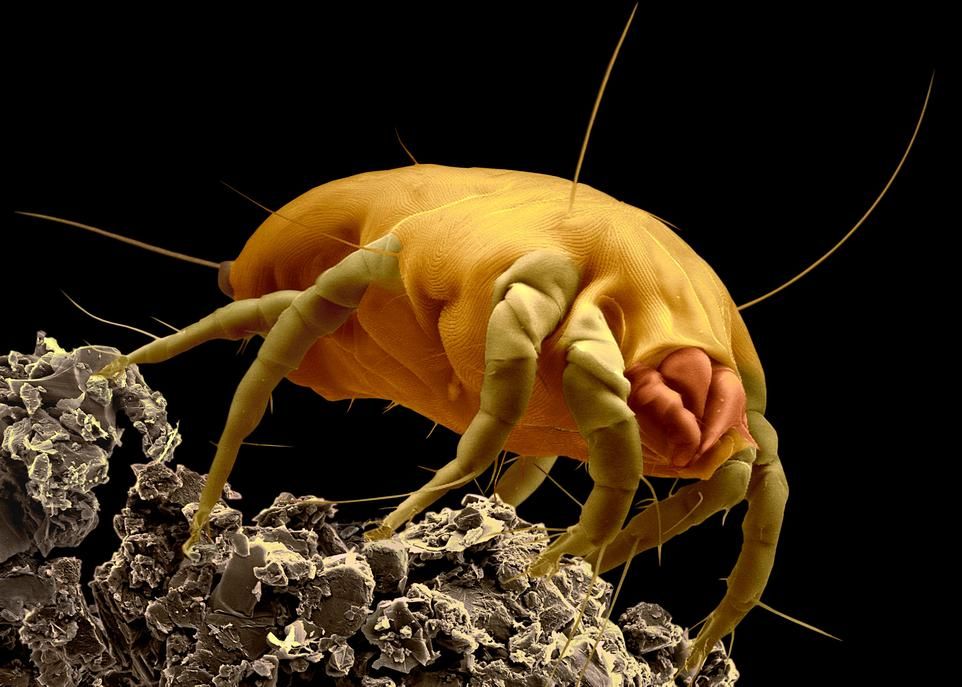 <p>Pour étudier les mécanismes responsables des allergies, les chercheurs ont exposé des souris et des cellules humaines à des extraits d'acariens et à de la tropomyosine. Cette protéine se retrouve chez les acariens (notre photo), mais aussi chez les crevettes et autres crustacés. On lui attribue une bonne partie des allergies aux fruits de mer.</p>