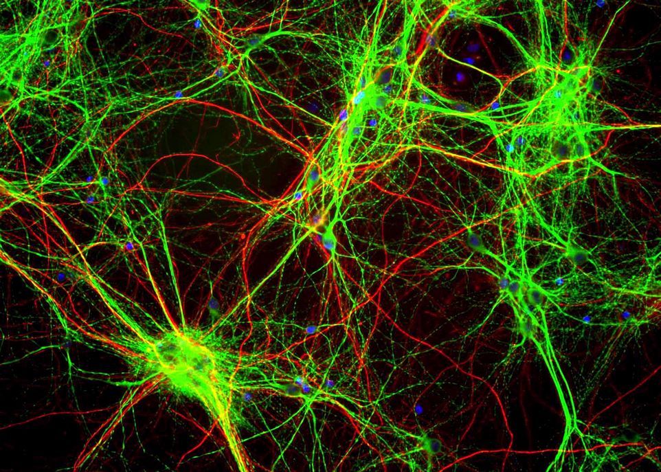 <p>La migration d'un axone (la partie allongée d'un neurone) qui cherche à se connecter à sa cible dans le cerveau est un bon exemple de comportement cellulaire nécessitant une voie de communication rapide et réversible.</p>