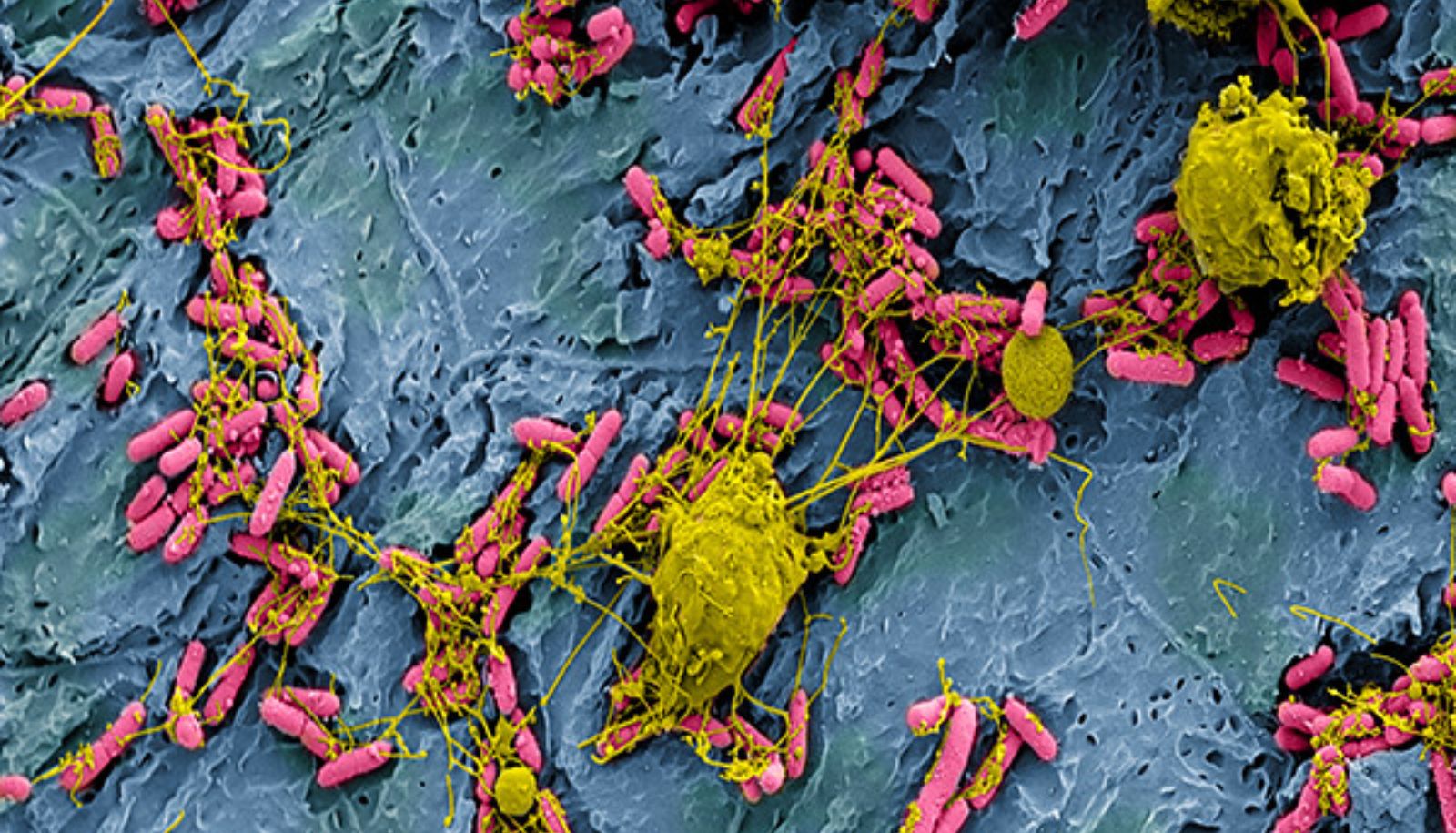 La bactérie E. coli est l'une des principales causes des infections urinaires chez l'humain. Sur l'image, des bactéries E. coli (en rose) attachées à la vessie (en bleu) d'une souris sont attaquées par des leucocytes (en jaune).