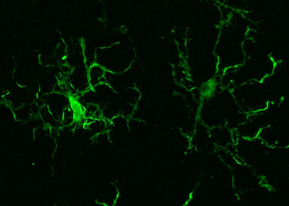 <p>La presque totalité des connaissances sur les cellules microgliales provenait d'études menées sur des souris. Pour pallier le manque d'information sur la microglie humaine, les chercheurs ont eu recours à des échantillons de cerveau prélevés sur 19 patients opérés pour cause d'épilepsie, de tumeur au cerveau ou d'ischémie grave. </p>