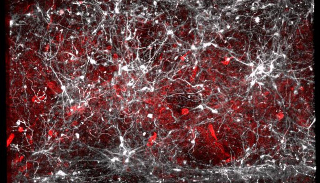 <p>Le réseau vasculaire cérébral (en rouge) assure la livraison d'éléments nutritifs et d'oxygène aux cellules du cerveau, notamment aux neurones dopaminergiques que l'on voit ici en blanc. Son bon fonctionnement est essentiel à la santé du cerveau.</p>