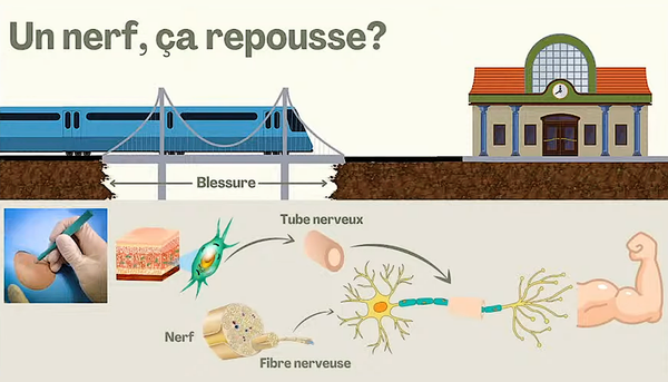 <p>La procédure consiste à prélever un petit bout de peau sur le patient, à en extraire les différentes cellules et à les multiplier en laboratoire, ensuite à faire pousser un nerf reconstruit que l’on pourra greffer chez le patient.</p>