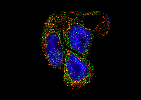 <p>Les nouvelles protéines UGT, en rouge, sont en contact avec les enzymes UGT, en vert, dans les cellules humaines, modulant ainsi l'activité de détoxification de ces enzymes. Les points de contact apparaissent en jaune.</p>