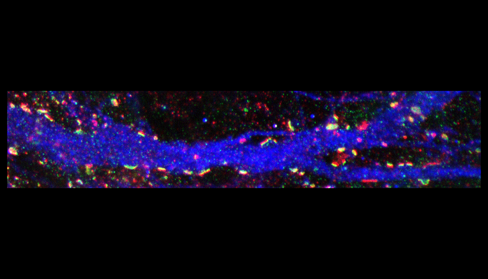 Exemple d’une image typique utilisée dans le cadre du projet conjoint entre l’Université Laval et l’Université de Toronto. Les synapses sont en vert et rouge. L’image a été produite avec un microscope à super-résolution. En bleu: le marquage de la protéine tyrosine hydroxylase pour identifier les neurones dopaminergiques affectés dans la maladie de Parkinson. En vert: la protéine post-synaptique PSD95. Et en rouge: la protéine pré-synaptique Bassoon. Les protéines PSD95 et Bassoon sont utilisées pour identifier les synapses et déterminer comment elles sont affectées par les modèles de la maladie de Parkinson et de la sclérose latérale amyotrophique.