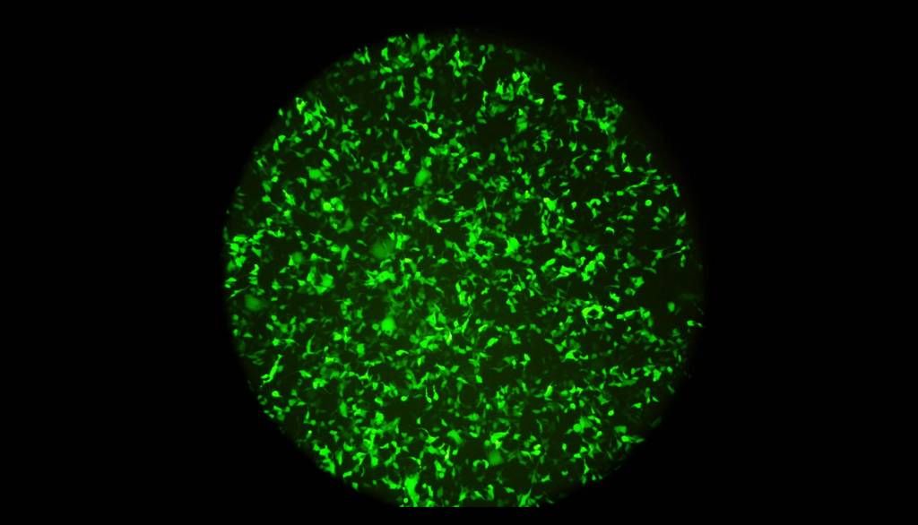 <p>Cellules en culture produisant la protéine fluorescente appelée GFP. C'est le gène de cette protéine que Juliette Champeil et Mathias Mangion intégreront dans leurs particules pseudo-virales afin de détecter la présence de molécules capables de neutraliser le virus du SARS-CoV-2 (coronavirus).</p>