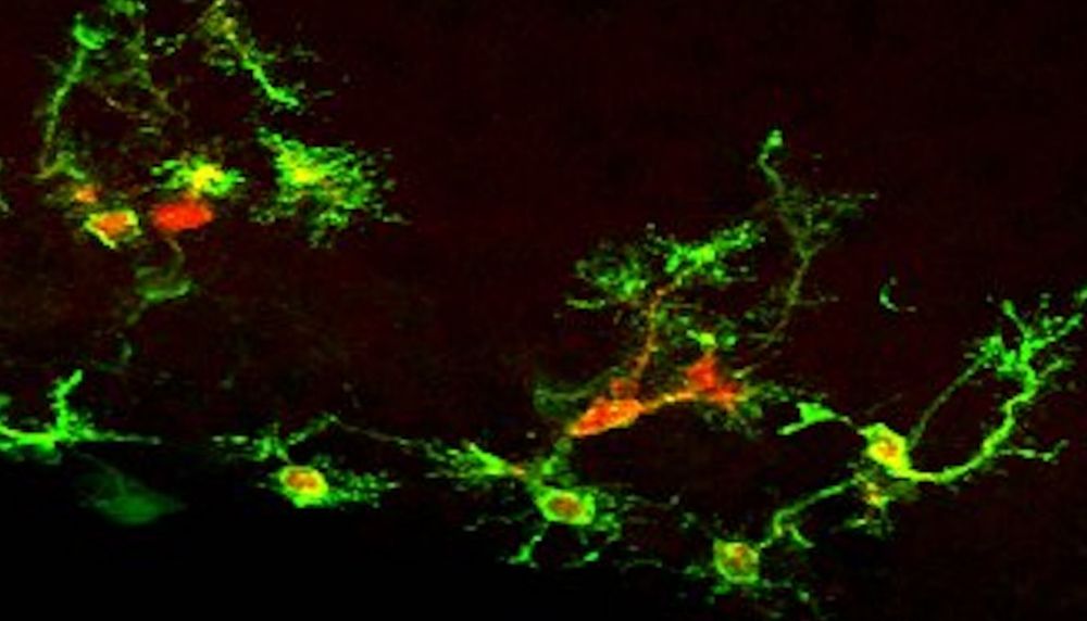 <p>Cette image montre des cellules souches neurales de souris adultes. Leur présence est détectée grâce à l'expression simultanée de deux gènes qui produisent des protéines fluorescentes de couleur rouge et de couleur vert.</p>