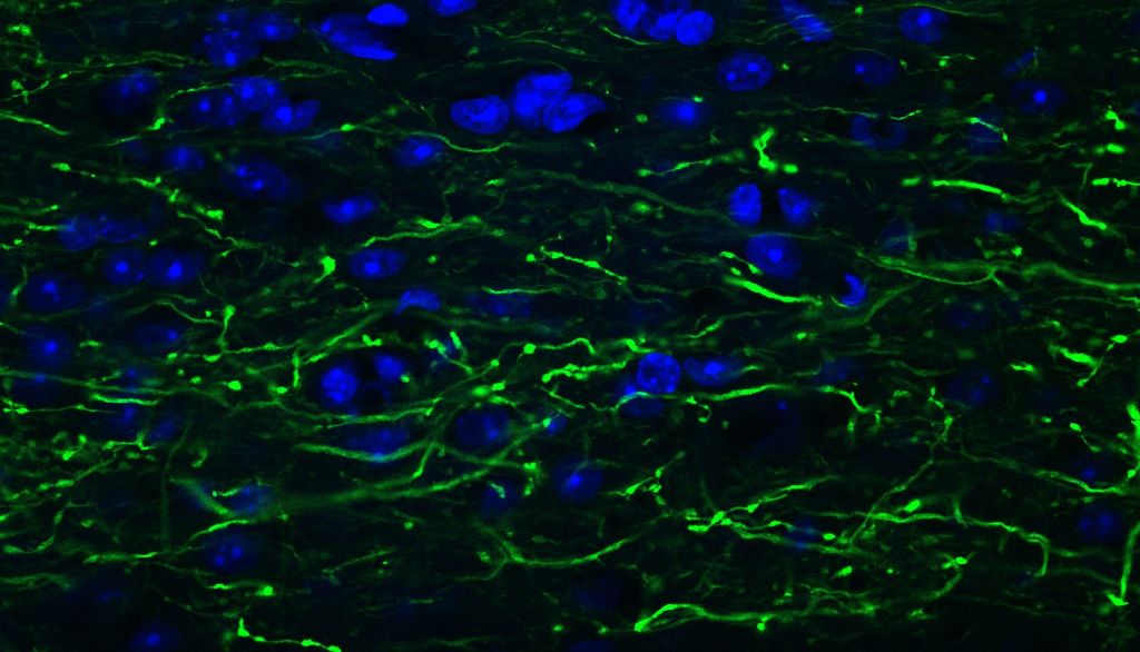 <p>Les structures vertes que l'on voit dans cette image de la moelle épinière d'une souris correspondent à la partie allongée des neurones. Elles contiennent des protéines fluorescentes vertes. Le gène qui a servi à les produire a été introduit dans les cellules à l'aide d'un virus modifié.</p>