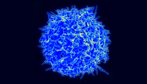 Les deux tiers des patients hospitalisés en raison de la COVID-19 présentent des taux anormalement bas de lymphocytes. Ces cellules jouent un rôle central dans la réponse immunitaire contre les infections.