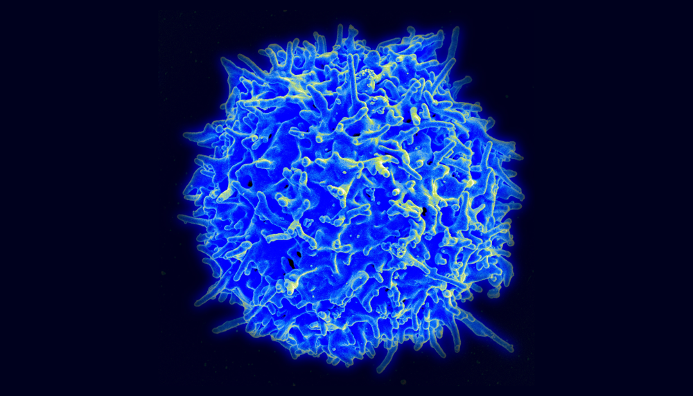 Les lymphocytes T4 jouent un rôle important dans le système immunitaire. Certains symptômes de la COVID longue pourraient résulter de la mort de ces cellules pendant la phase aiguë de l'infection.