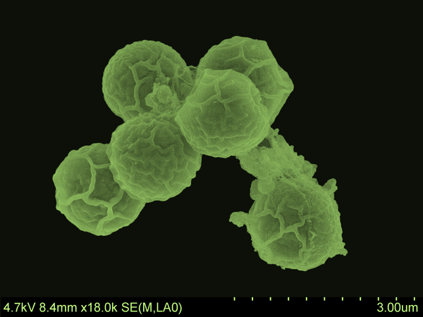 <p>La picoalgue C. primus a un génome composé de 20 chromosomes, dont 19 sont présents en deux copies, une caractéristique qui n’avait pas encore été observée chez les algues vertes microscopiques. </p>