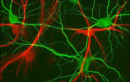 <p>Le dérèglement cellulaire serait également en cause dans le stress chronique, l'anxiété, l'autisme, l'épilepsie, voire même l'autisme et la schizophrénie.</p>