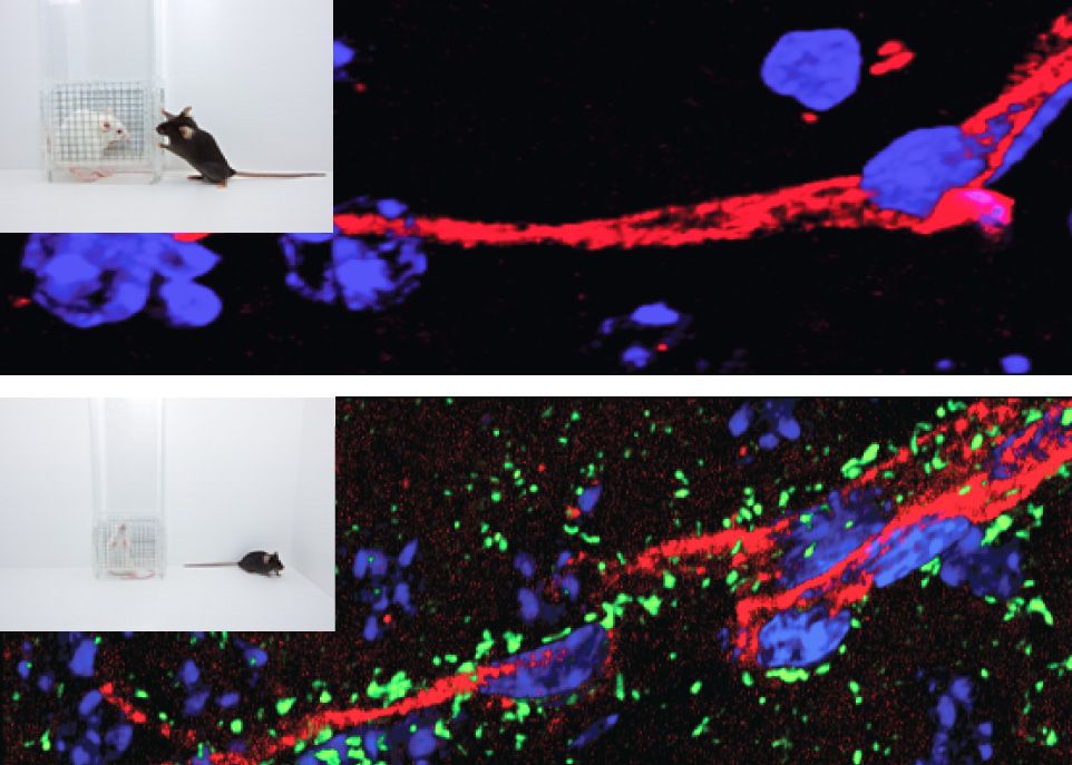 Le stress social chronique provoque des altérations de la barrière hématoencéphalique chez les souris déprimées (image du bas) permettant le passage entre les cellules endothéliales (en rouge) de molécules pro-inflammatoires, l'interleukine-6 (en vert), du sang vers le cerveau. Les souris résilientes au stress (image du haut) maintiennent une barrière hématoencéphalique imperméable et des comportements normaux, notamment des interactions sociales.