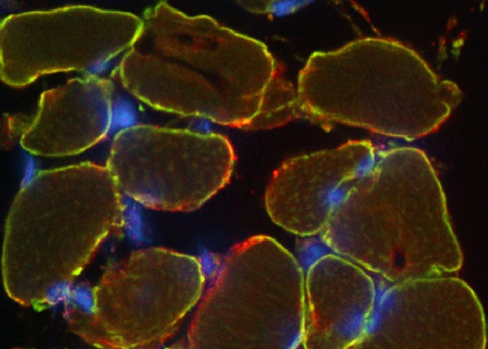Cette coupe transversale d'un muscle à contraction rapide montre, en rouge, la localisation de la protéine RANK dans la membrane des fibres musculaires. C'est la première fois que la présence de RANK dans les muscles et sa localisation dans le pourtour des fibres musculaires sont démontrées.