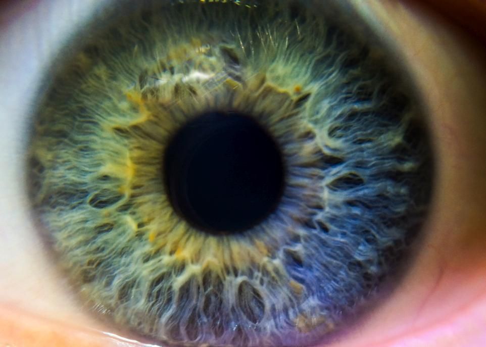 <p>Des sons inhabituels activent le système sympathique qui exerce une influence un peu partout dans le corps, notamment dans certaines zones du cerveau connectées aux muscles de la pupille. Lorsque ces connexions sont activées, le diamètre de la pupille augmente, ce qui permet le passage de plus de lumière, donc de plus d'information visuelle en situation d'alerte.</p>