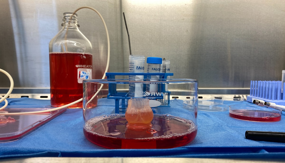 La valve cardiaque après la dissolution du moule en sucre et avant la mise en culture dans le bioréacteur. Le milieu de culture cellulaire, le liquide rouge, contient des nutriments pour les cellules.