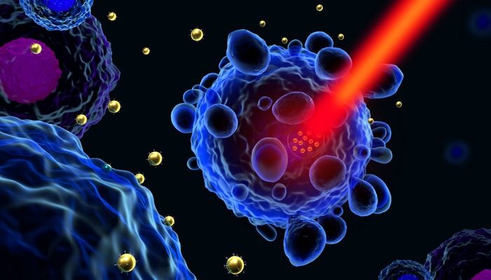 Pour tuer les cellules cancéreuses, une molécule thérapeutique est transportée dans une nanoparticule puis activée par la lumière.