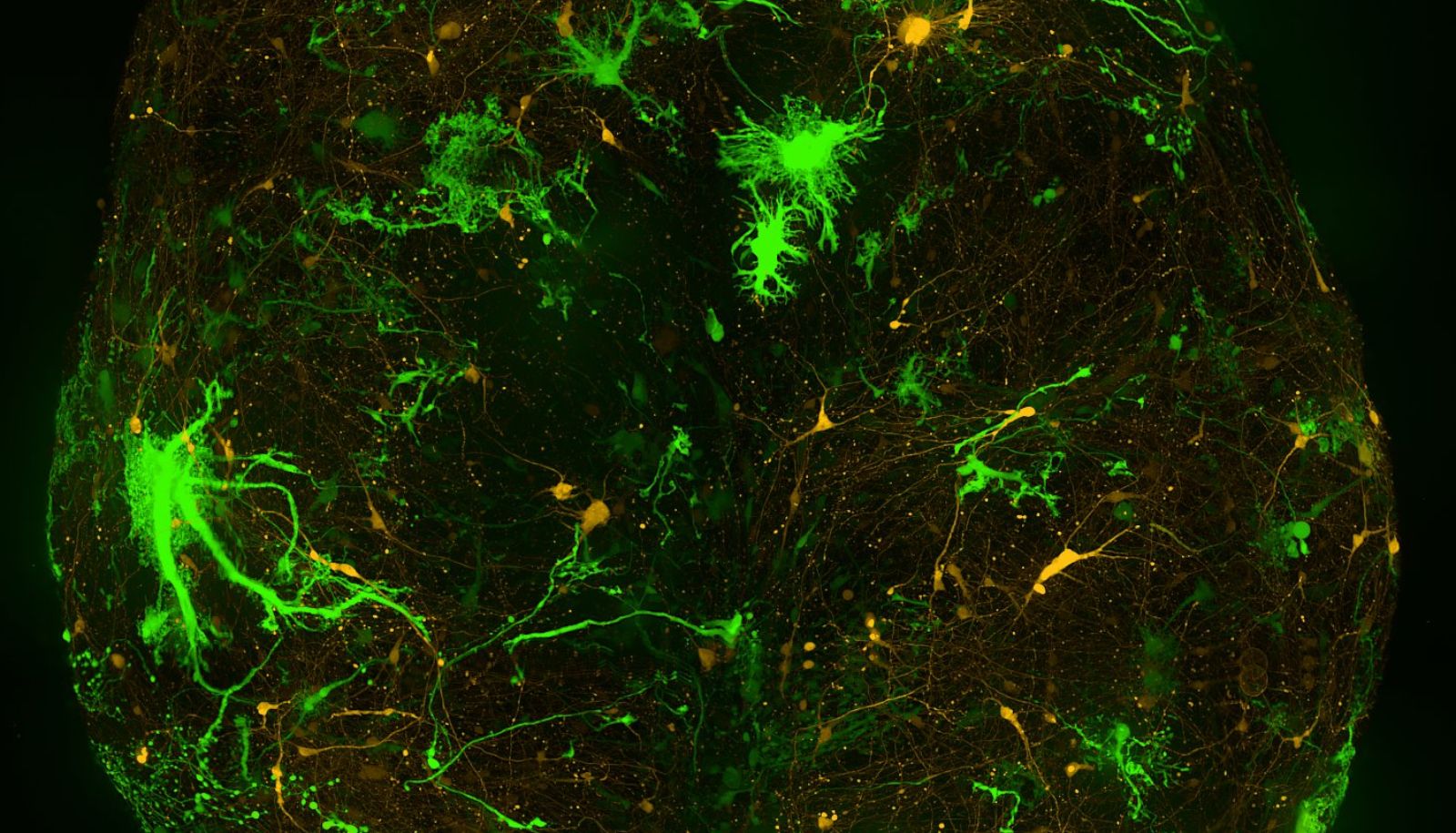 Cette image montre ce qu'il est possible de réaliser avec des outils optogénétiques. Grâce à deux vecteurs viraux, on peut discerner des astrocytes (en vert) et des neurones (en jaune) dans une culture de cellules humaines.