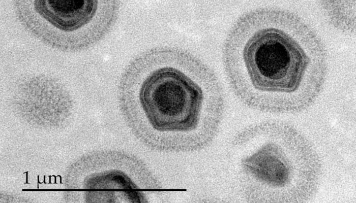 Microscopie électronique en transmission (MET) montrant des particules de Mimivirus purifiées, virus géant infectant l'amibe Acanthamoeba castellanii. 