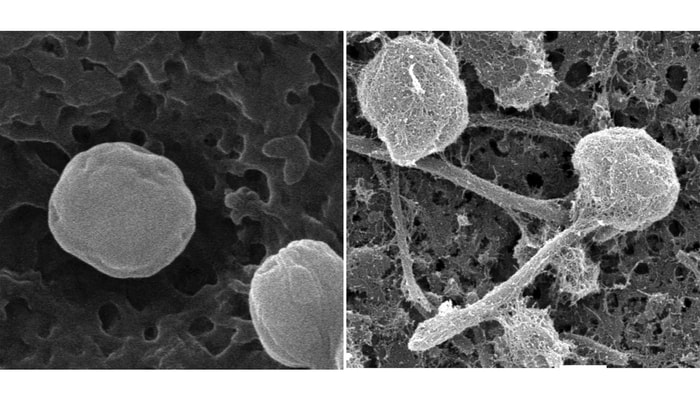 Une image en microscopie électronique de balayage de la forme sphérique et flagéllée de Pseudoscourfieldia marina