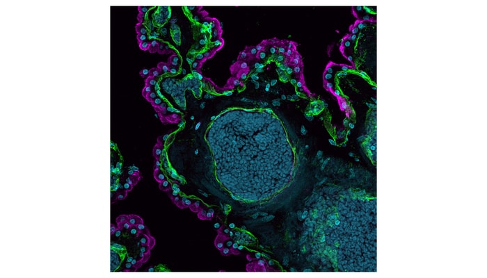 Une coupe du plexus choroïde sous microscopie confocale