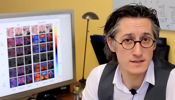 L'alzheimer n'est pas une maladie ayant une cause unique, mais un syndrome aux causes multiples, soutient Simon Duchesne. «Il faut y répondre en développant des traitements personnalisés qui ciblent les mécanismes impliqués dans chaque cas, ainsi que des stratégies de prévention intégrant à la fois le mode de vie, l'environnement et la biologie.»