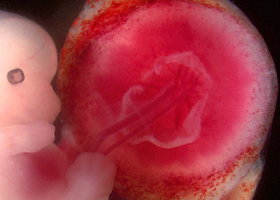 Pendant la grossesse, des fragments d'ADN provenant du placenta se retrouvent en faible concentration dans le sang de la mère. On peut mesurer cet ADN fœtal dès la 10e semaine de grossesse et déterminer, avec une efficacité proche de 99%, si le fœtus est atteint de trisomie 21.