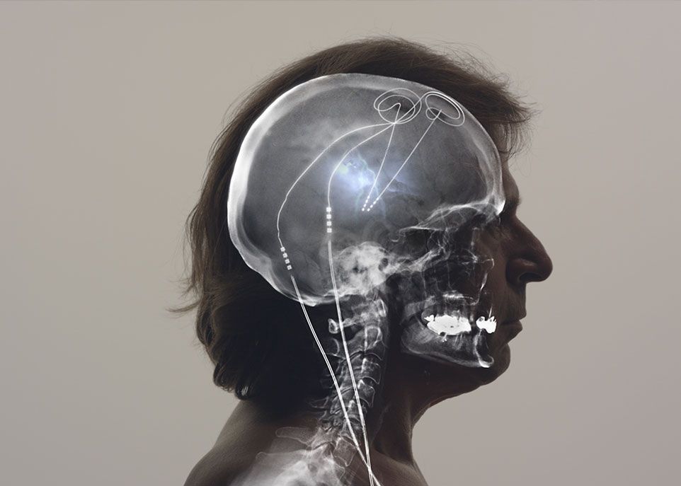 <p>Le personnage de Lucien Kovacic se présente comme un conseiller en bien-être et un explorateur de l’esprit. À travers la fusion entre l’intelligence biologique et l’intelligence artificielle, il cherche à «mettre le système d’opération de l’humanité à jour».</p>