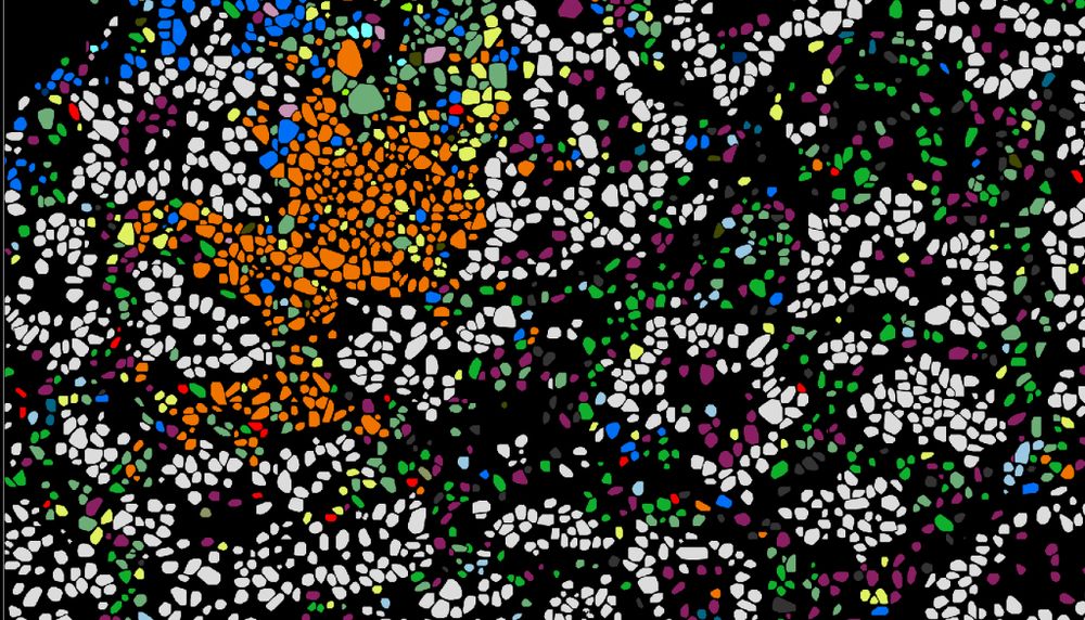Chaque point sur cette image représente une cellule. Les points blancs sont des cellules tumorales de cancer de poumon. Les points d'autres couleurs, qui correspondent à d'autres types de cellules, forment le micro-environnement de la tumeur.