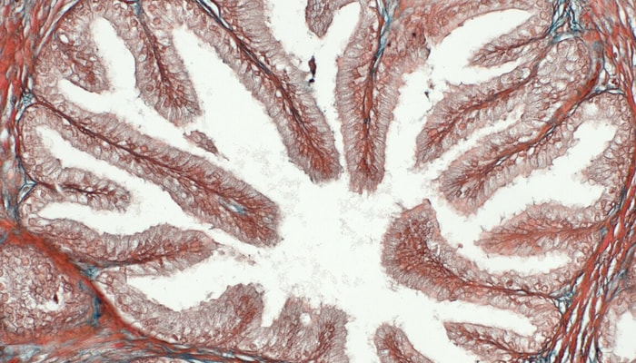 Cette image prise au microscope montre la structure glandulaire de la prostate. Chez les hommes en bonne santé, les cellules de la prostate secrètent du citrate qui se retrouve dans le liquide séminal. Dans les cellules cancéreuses, la sécrétion de citrate diminue de 10 à 100 fois, ce qui en ferait un marqueur très intéressant pour le cancer de la prostate, estime le professeur Étienne Audet-Walsh.