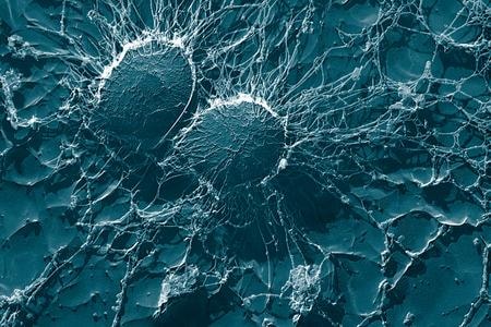 Le staphylocoque doré est l'une des bactéries pathogènes les plus fréquemment rencontrées dans les produits laitiers. Elle sécrète une toxine qui cause des empoisonnements alimentaires chez l'humain.