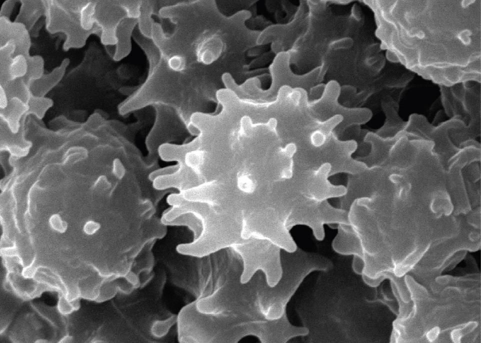 Les boutons que l'on voit à la surface des globules rouges grandissent et s'en libèrent, donnant naissance à des microvésicules extracellulaires. Leur nombre et leur contenu en protéines pourraient servir de biomarqueur pour établir le stade de la maladie de Parkinson et pour suivre son évolution.