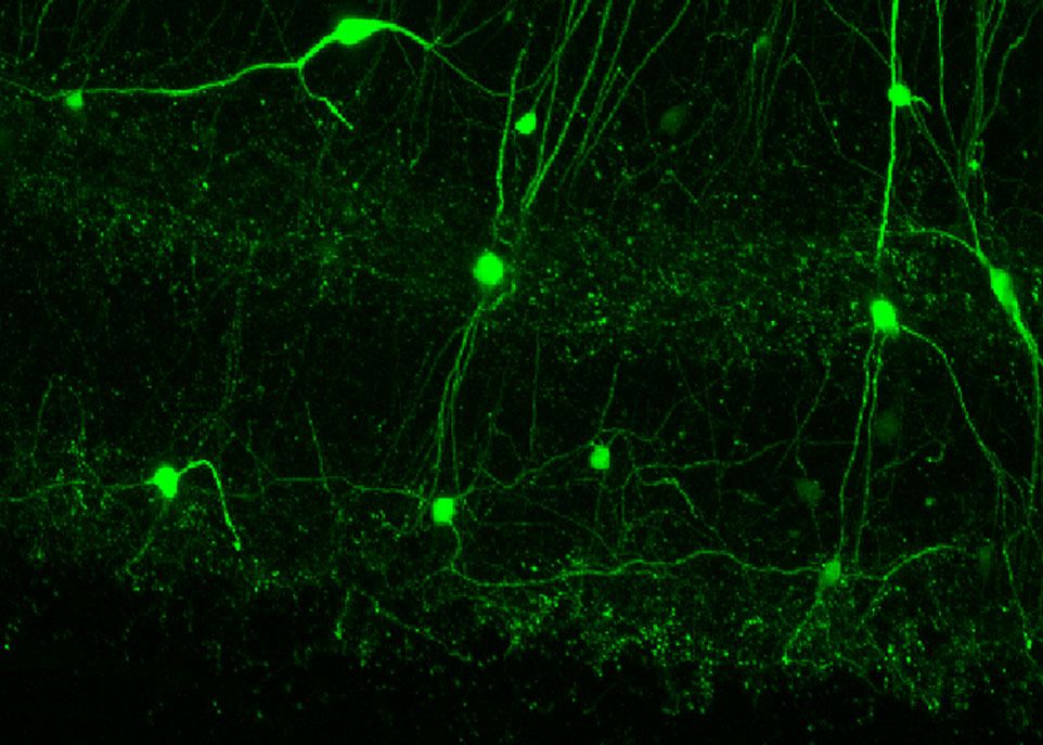 Sur cette photo, les neurones découverts par les chercheurs sont colorés à l’aide de la protéine fluorescente verte. Ces neurones assurent la communication entre deux régions du cerveau qui interviennent dans le stockage et le rappel des informations mémorisées.
