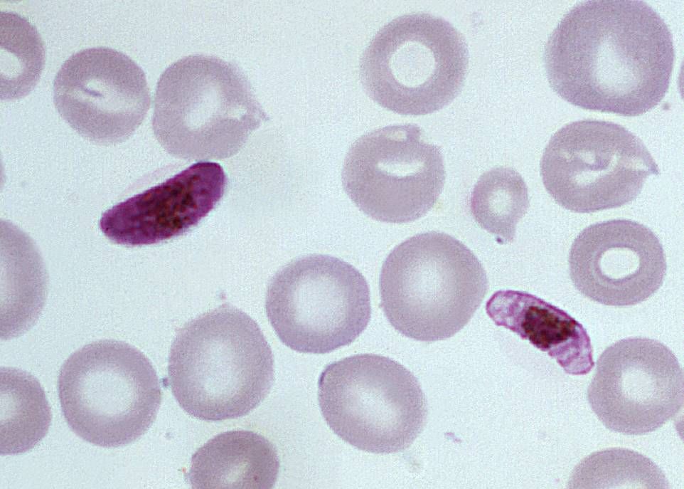<p>Le parasite Plasmodium falciparum est responsable de la moitié des cas de malaria. Trois des quatre molécules synthétisées par les chercheurs se sont révélées efficaces contre ce parasite.</p>