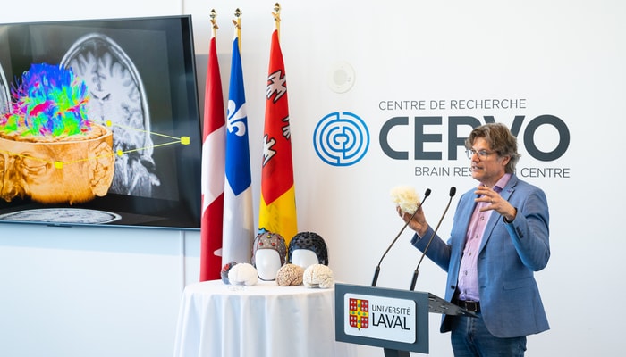 Steven Laureys, titulaire de la Chaire d’excellence en recherche du Canada en neuroplasticité.